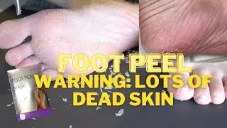 Oddly Satisfying Foot Peel - Lavender Foot Peel Mask Review