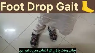 Identifying Drop Foot: Understanding Gait and Foot Position