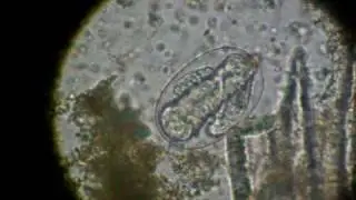Egg of a parasitic nematode ready to hatch