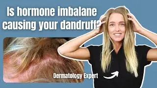 Seborrheic Dermatitis and Hormones | How to Heal Dandruff Naturally