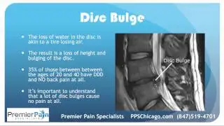 Disc Bulge and Disc Herniation Explained by a Top Chicago Pain Center