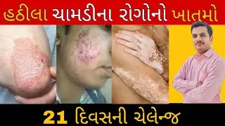 ચામડીના રોગોને દુર કરવાની શ્રેષ્ઠ દવા | best remedie to cure skin disease | Anup Mehta 