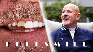 Smile Makeover / Testimonial