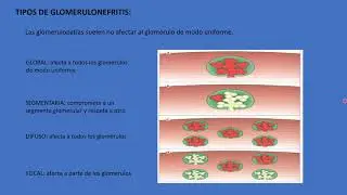 Patología vías urinarias altas I