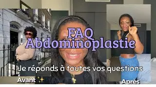FAQ Abdominoplastie | Je réponds à toutes vos questions 🧐