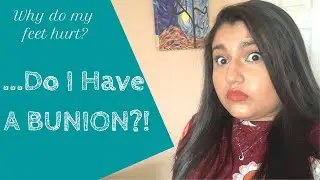 Why do my feet hurt?...Do I Have A Bunion?!