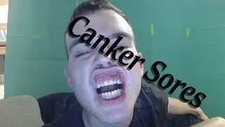 Deadiffer's way to get rid of Canker Sores!