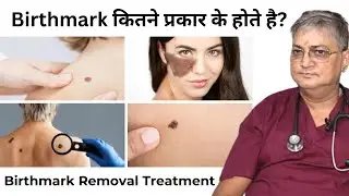 How Birthmark Removal Actually Works