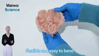 High Simulation Pathological Anatomy Model Duodenal Ulcer