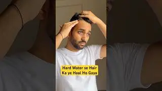 Water Softener for Hard Water at Home | WaterScience Shower Filter