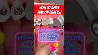 HOW TO APPLY WAX ON BRACES *what to do if you RUN OUT! #braces #wax #asmr