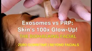 The Biohacking Facial: Exosomes Treatment in Santa Monica &ndash; Outshines PRP & Vampire Facials!