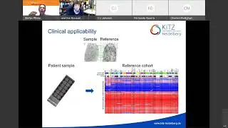 011 Mapping Childhood Brain Tumor Profiles Onto Normal Development Identifies Novel