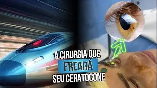 A cirurgia que freará seu ceratocone