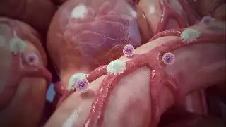 Fibrofind: Technology to Study Kidney Disease