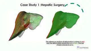 12 Real-Time Modeling of Tissue Deformations via Physics-Based Deep Learning.