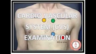 CARDIOVASCULAR SYSTEM CVS  EXAMINATION