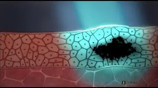 Oral Cancer Screening Australian Accent
