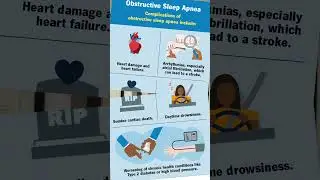 Sleep Apnea Awareness #sleepapnea #sleep #airwaydentistry #airwaydentist #miamidentist #drnassery