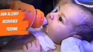 Adorable Baby Recovered from Skin Allergy💕 |Healthy & Feeding Happily 👶 #BabyRecovery #NewbornCare&rdquo;
