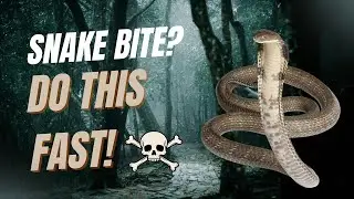 Snake Bite Emergency: Most People Get THIS Wrong