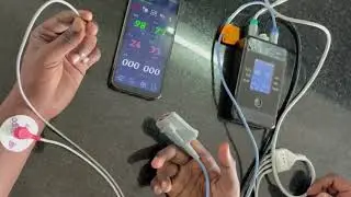 Measurement of various physiological signals using biotelemetry