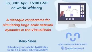 World Wide Series | Open Neuroscience - 30/04/2021 - Kelly Shen
