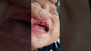 GUSI BABY DIEGO BERDAR4H, DINAR NANGIS KEJER😢😭 #shorts #short