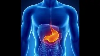 Causes of Colon Cancer
