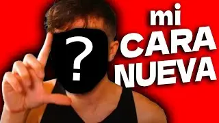 esta es... MI NUEVA CARA (después de las cirugías)