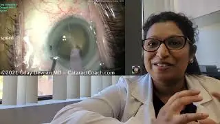 When Should You Get Cataract Surgery? Why Earlier Is Often Better? Benefits, Risks and Recovery Time