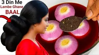 Black Tea & Onion For 10x Faster Hair Growth Remedy✨️Chai Patti Me Ye Mix Kare Baal 100% Lambe Ghane