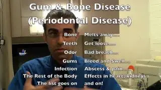 Naperville Family Dentist Answers  Questions About Deep Cleaning