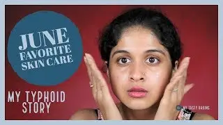 HOW I TOOK CARE OF MY SKIN DURING TYPHIOD | A video after a long time | Mrudhula Basker