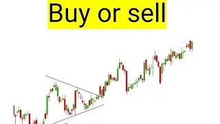 Lexeo Therapeutics Inc, lxeo stock analysis buy or sell