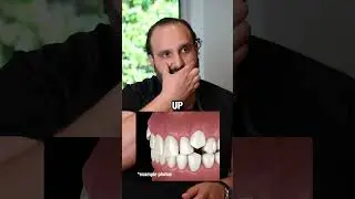 Here&rsquo;s why your bite matters 👆🦷 #SmileCase #FloridaDentist #GrindingTeeth