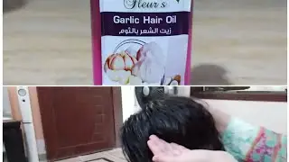 My son's haircare routine || hemani garlic oil