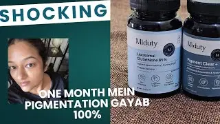 Honest Review Miduty | 1 mahine mei gayab 6 sal purana pigemntation#miduty #supplemnet #pigmentation