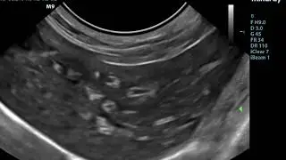 Small Animal Ultrasound - Starry night Liver