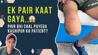 Nasir's new journey after below knee prosthesis | From Kashipur to Delhi