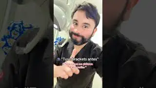 #youtubeshorts #dentista #shortsmexico