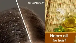 How to remove lice from hair#neem hair oil#haircare #diy home remedie#silky & smooth hair 