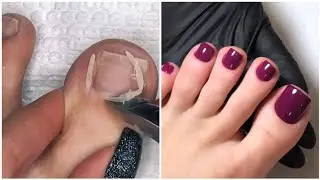 Most Satisfying Pedicure Transformation 😱 best nail polish for toes 2022