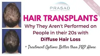 Treating Diffuse Hair Loss in Men - Why Transplants Can't be Done, and Better Treatment than PRP