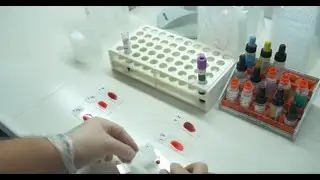 Come vengono determinati i gruppi sanguigni?