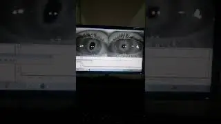 Discoria videonistagmograf&iacute;a seguimiento ocular lento