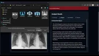 MEDSCAN - AI Radiology Assistant