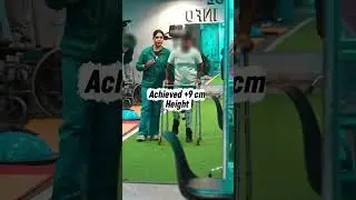 First Walking After Frame Removal | Height Increase Surgery | Limb Lengthening Surgery in India