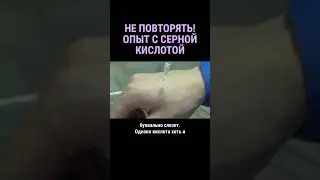 Не повторять! ⚠️ Если серная кислота попадет на кожу #shorts