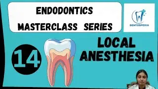 ENDO 14 Local Anaesthesia in Endodontics Explained #afk #ore #lds #mfds #adat #inbde #adc #NEETMDS